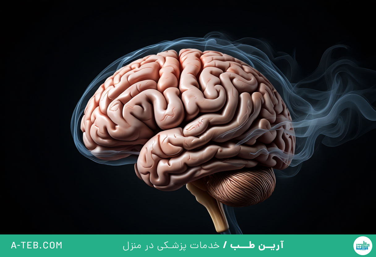 نشخوار فکری