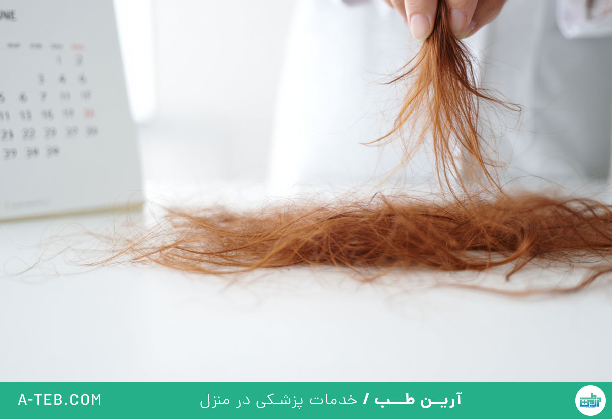 ریزش مو در تابستان