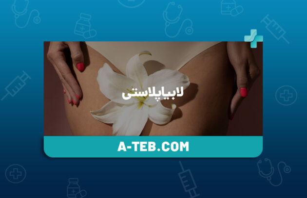 لابیاپلاستی