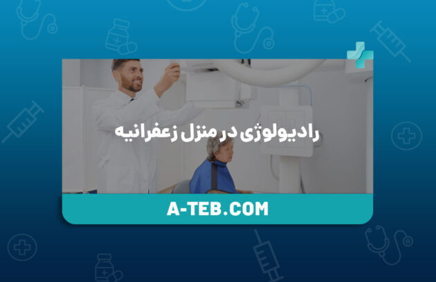 رادیولوژی در منزل زعفرانیه