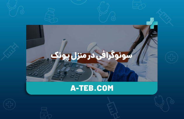 سونوگرافی در منزل پونک