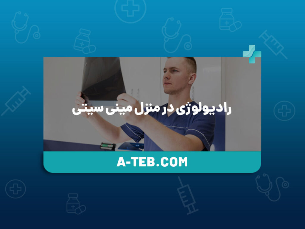 رادیولوژی در منزل مینی سیتی