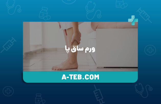 ورم ساق پا