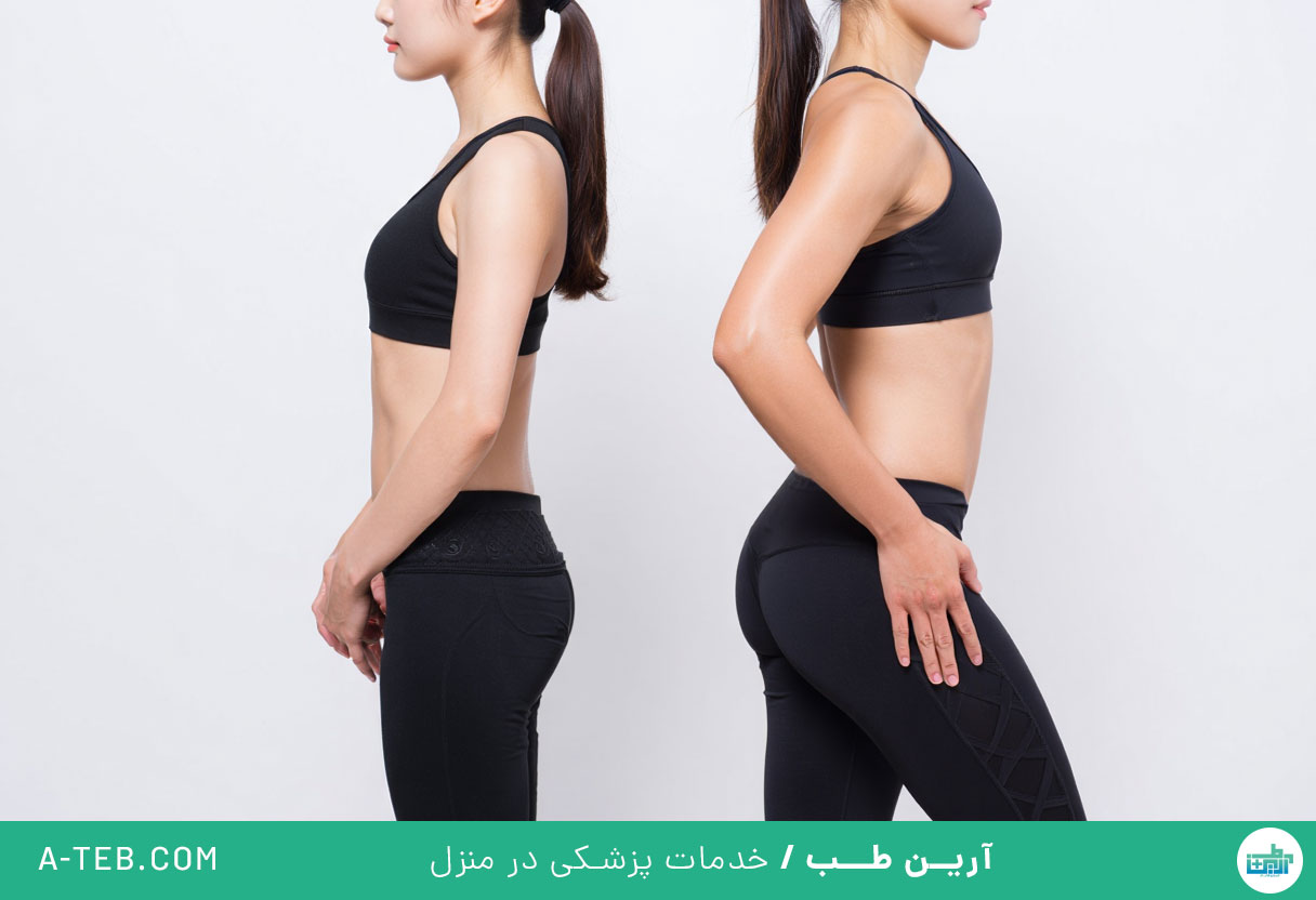 چاقی ران و باسن