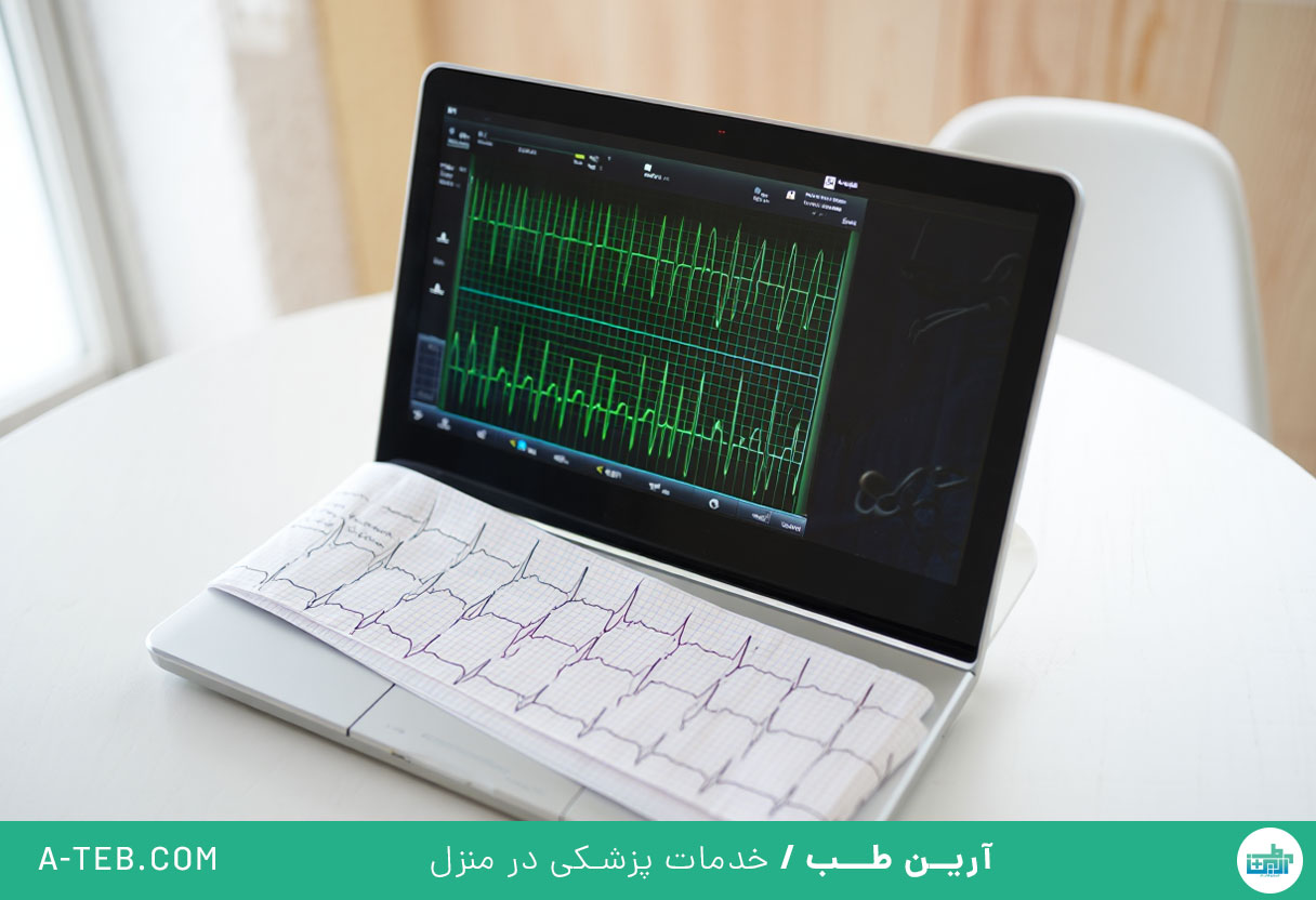 نوار قلب در منزل اوین
