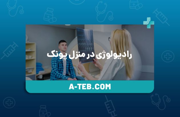 رادیولوژی در منزل پونک
