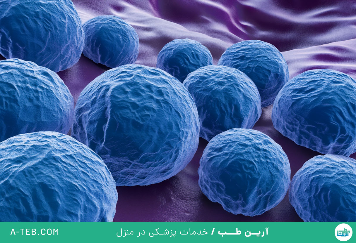 عفونت کلامیدیا