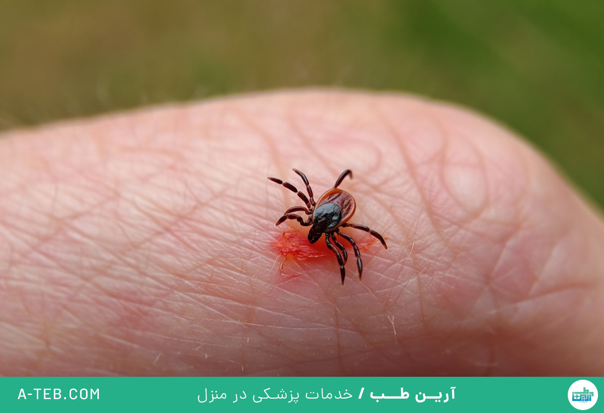نیش کنه در طبیعت