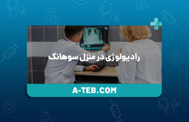 رادیولوژی در منزل سوهانک