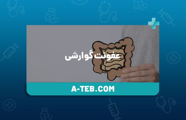 عفونت گوارشی