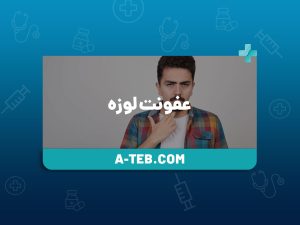 عفونت لوزه