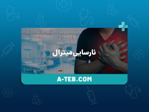 نارسایی میترال