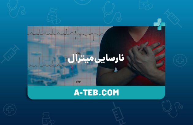 نارسایی میترال