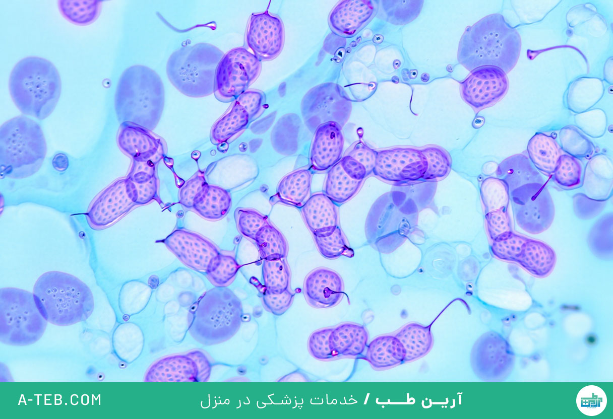تفاوت عفونت ویروسی و باکتریایی