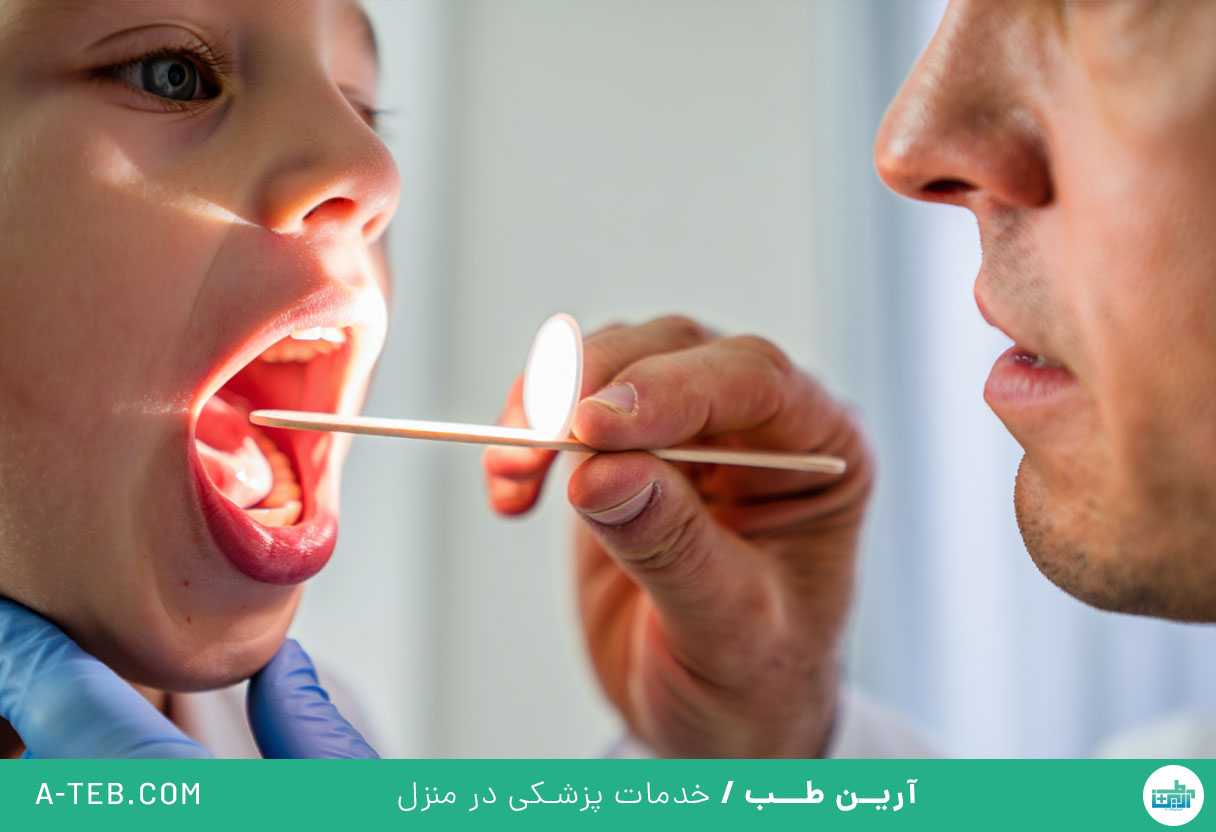 عفونت لوزه