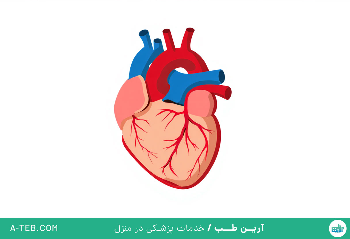 نارسایی آئورت