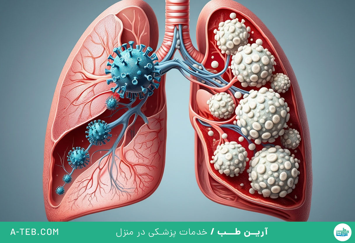 ویروس جدید تنفسی