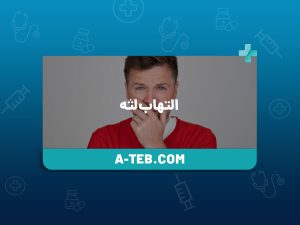 التهاب لثه