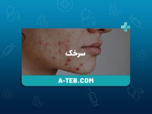 سرخک