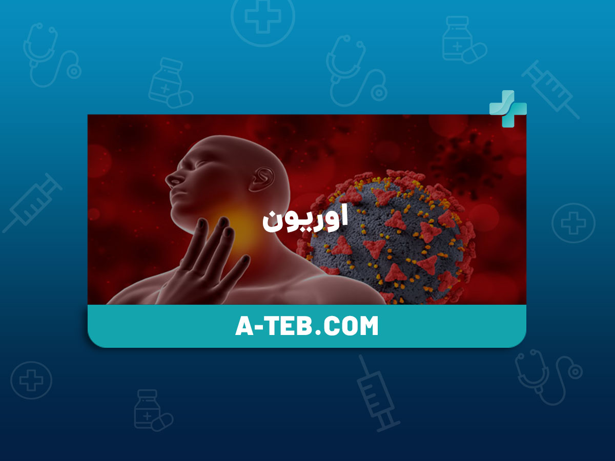 اوریون