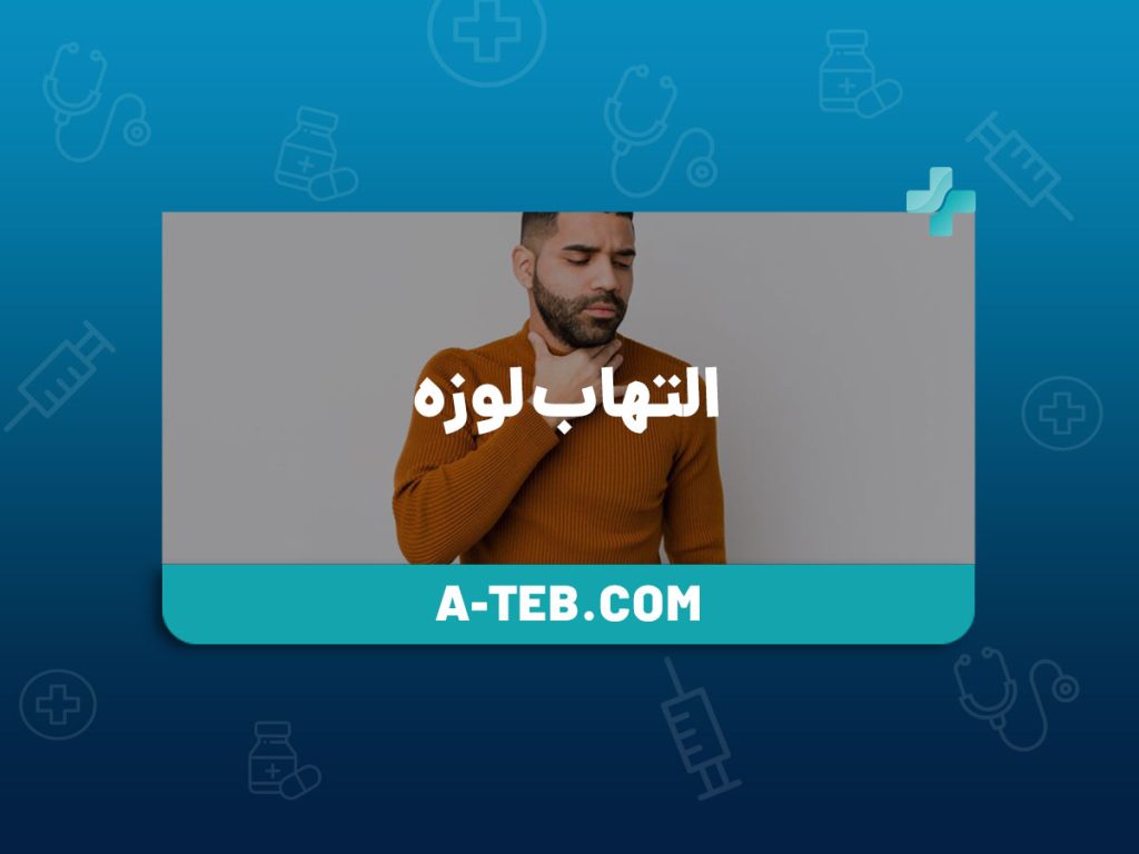 التهاب لوزه