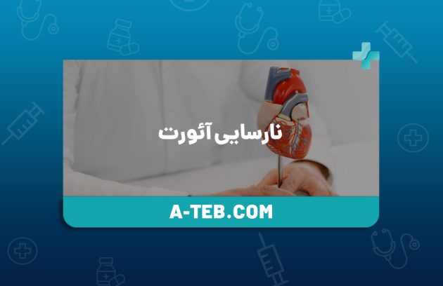 نارسایی آئورت