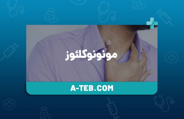 مونونوکلئوز