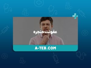 عفونت حنجره