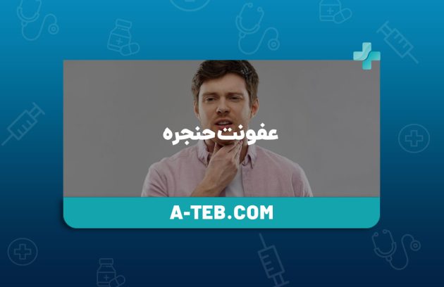 عفونت حنجره