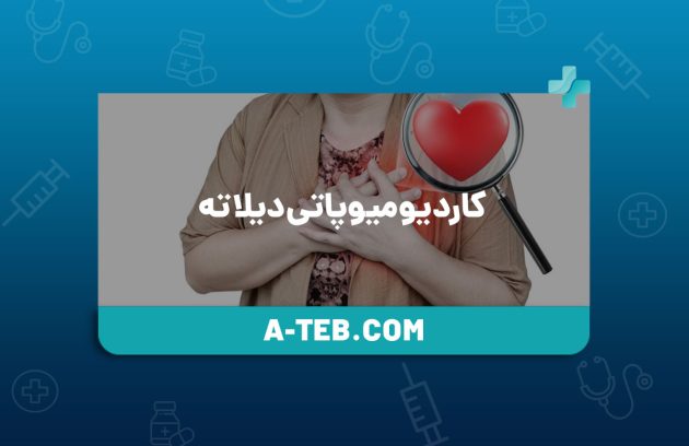 کاردیومیوپاتی دیلاته