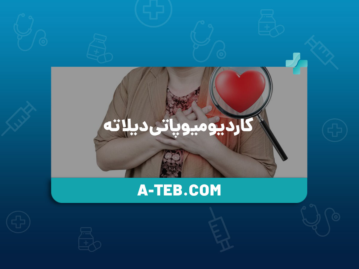 کاردیومیوپاتی دیلاته