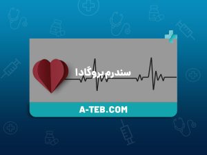 سندرم بروگادا
