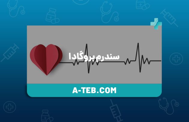 سندرم بروگادا