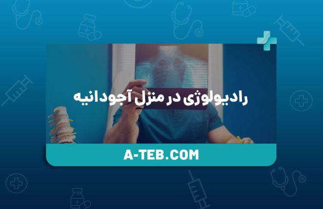 رادیولوژی در منزل آجودانیه