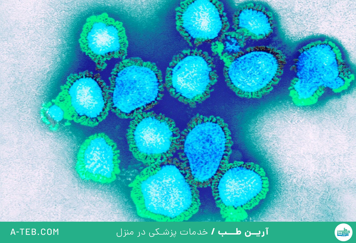 آنفولانزا h3n2