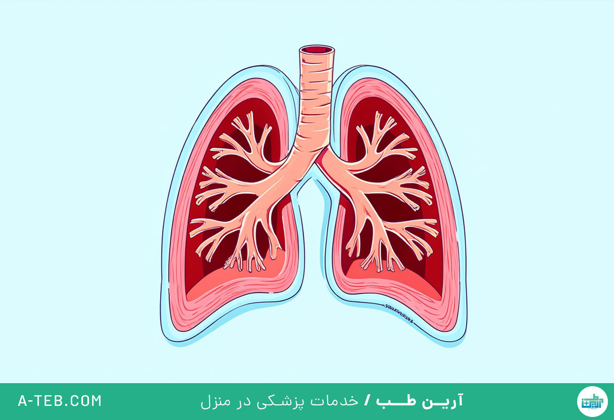 برونشکتازی