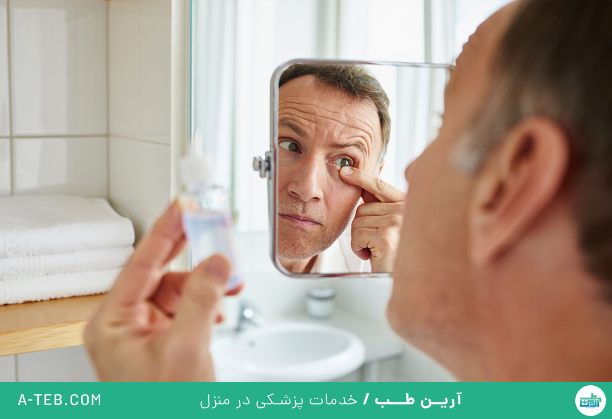 التهاب ملتحمه