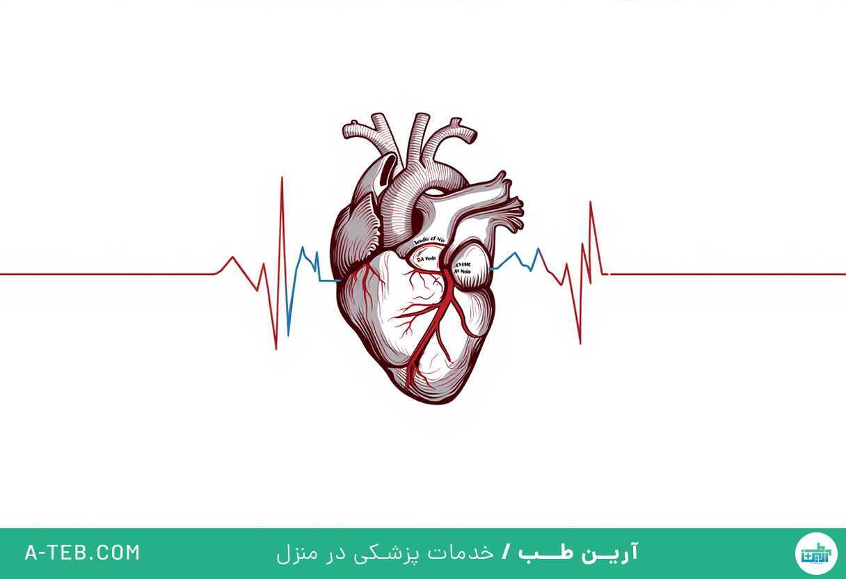 سندرم بروگادا