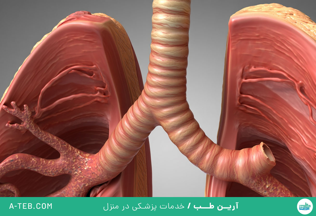 برونشکتازی