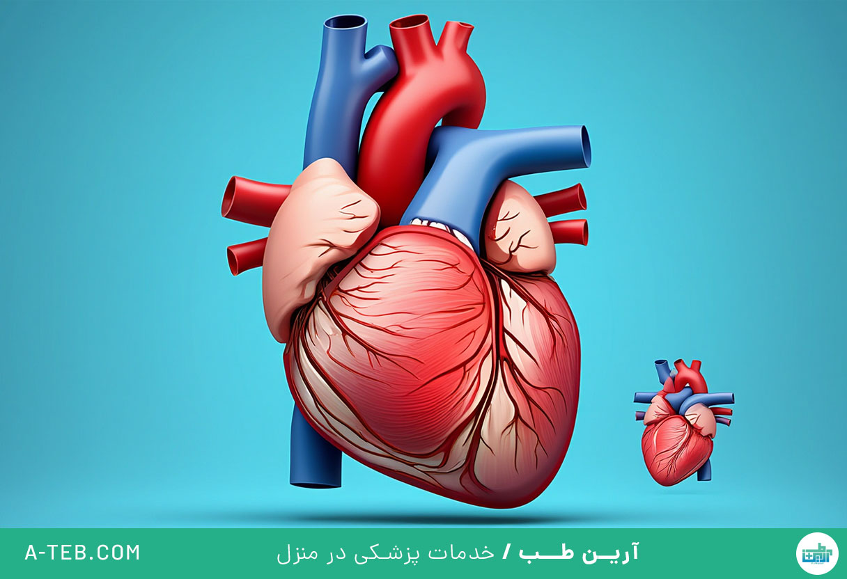 کاردیومیوپاتی دیلاته