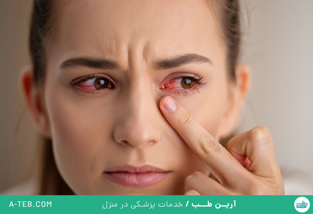 التهاب ملتحمه