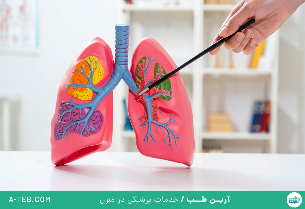 بیماری بینابینی ریه