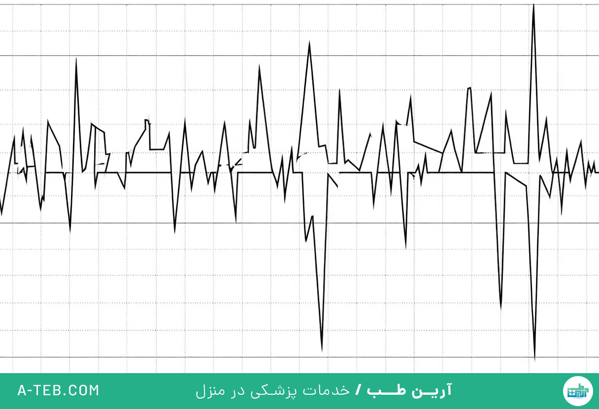 فیبریلاسیون بطنی