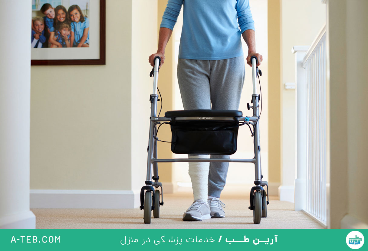 فیزیوتراپی بعد جراحی فمور در منزل