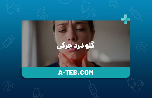 گلو درد چرکی