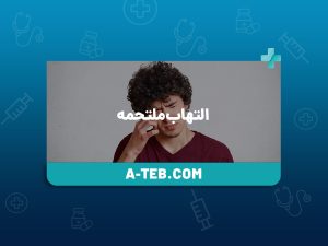 التهاب ملتحمه