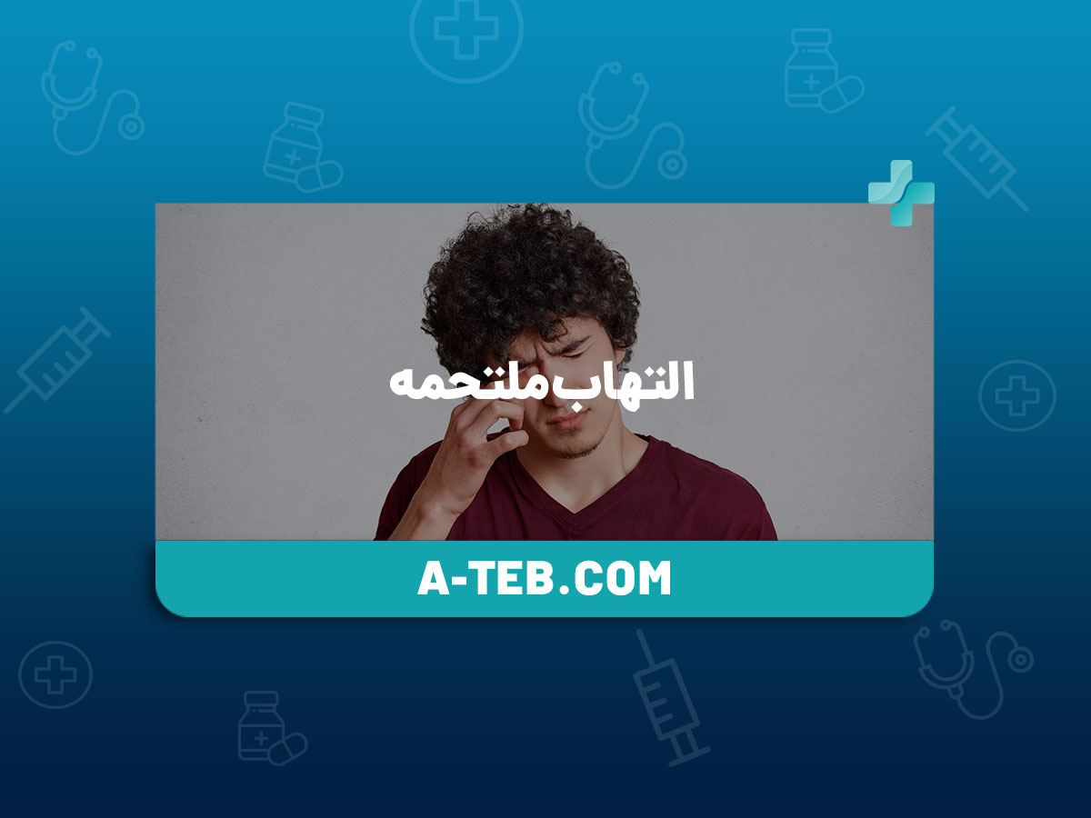 التهاب ملتحمه