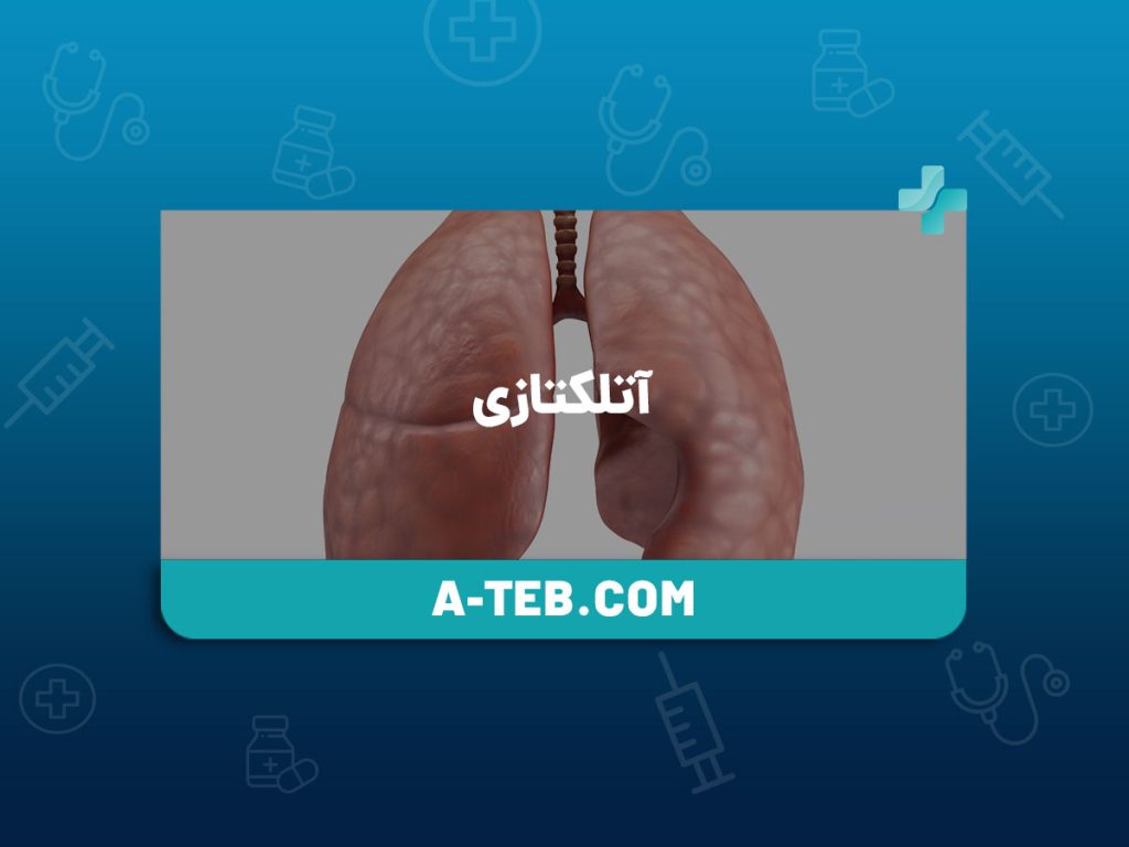آتلکتازی