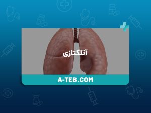 آتلکتازی