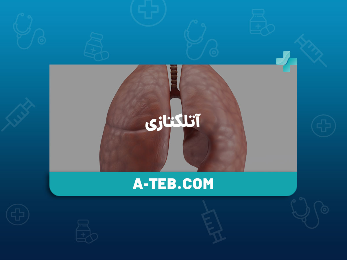 آتلکتازی